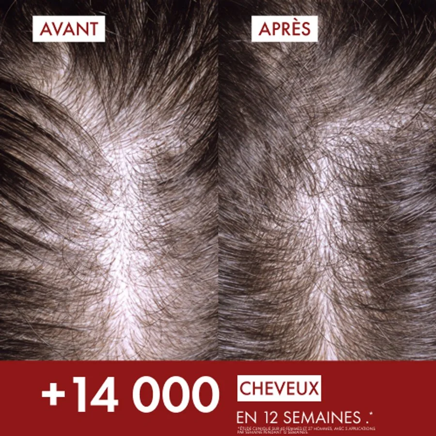 VICHY DERCOS AMINEXIL CLINICAL 5*21 FEMMES